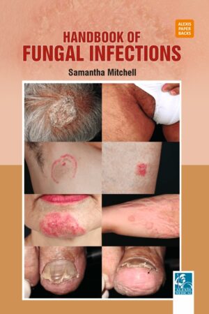 Handbook of Fungal Infections