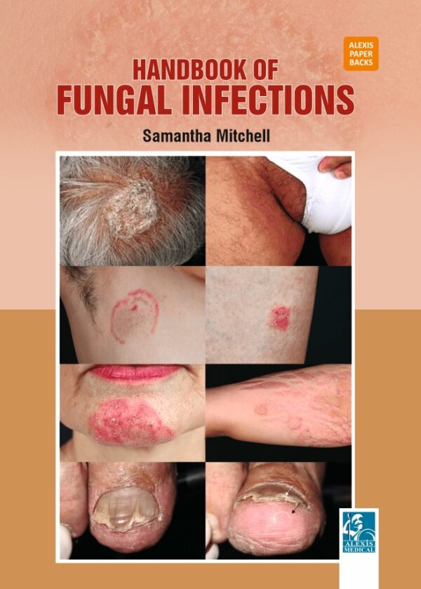 Handbook of Fungal Infections