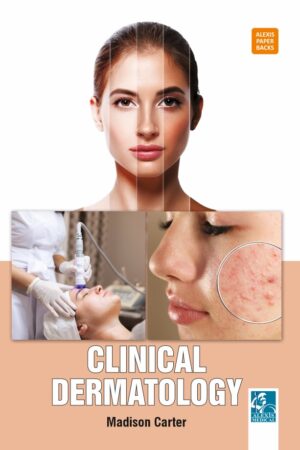 Clinical Dermatology