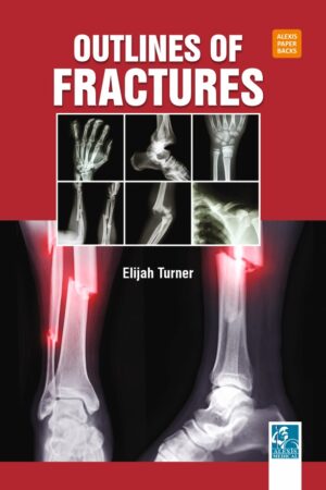 Outlines of Fractures