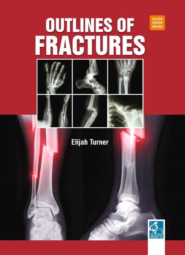 Outlines of Fractures