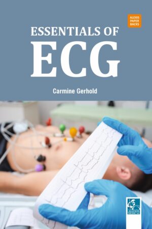 Essentials of ECG